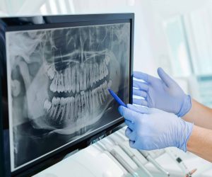 What-Are-The-Advantages-Of-Digital-Radiography-Digital-X-rays